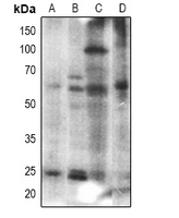 1 - Anti-Histone Deacetylase 2 Antibody AP61512