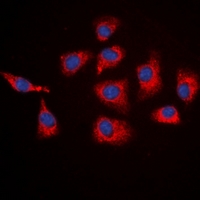 3 - Anti-SGK1 Antibody AP61513