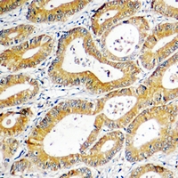 19 - Anti-SGK1 Antibody AP61513