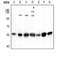 1 - Anti-SGK1 Antibody AP61513