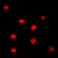 3 - Anti-Glucocorticoid Receptor Antibody AP61514