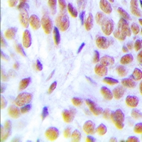 19 - Anti-Glucocorticoid Receptor Antibody AP61514