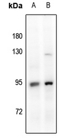 1 - Anti-Glucocorticoid Receptor Antibody AP61514