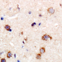19 - Anti-MYPT1 Antibody AP61515