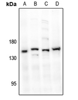 1 - Anti-MYPT1 Antibody AP61515