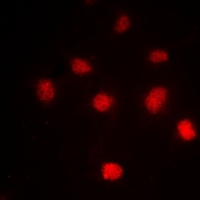 3 - Anti-Histone H4 (Acetyl-K5) Antibody AP61516