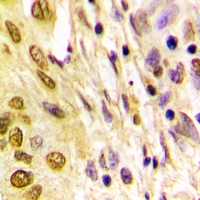 19 - Anti-Histone H4 (Acetyl-K5) Antibody AP61516