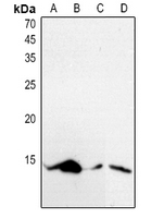 1 - Anti-Histone H4 (Acetyl-K5) Antibody AP61516
