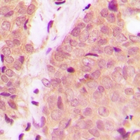 19 - Anti-IKK alpha/beta Antibody AP61517