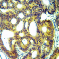 19 - Anti-ACE2 Antibody AP61518
