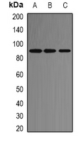 1 - Anti-ACE2 Antibody AP61518