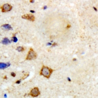 19 - Anti-TRAF6 Antibody AP61519