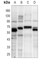 1 - Anti-TRAF6 Antibody AP61519
