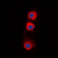 3 - Anti-PPP2CA Antibody AP61520