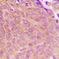 19 - Anti-PPP2CA Antibody AP61520