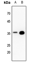 1 - Anti-PPP2CA Antibody AP61520