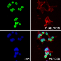 3 - Anti-HMGB1 (Acetyl-K12) Antibody AP61523