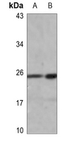 1 - Anti-HMGB1 (Acetyl-K12) Antibody AP61523