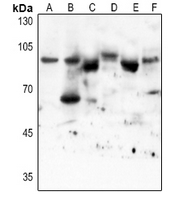 1 - Anti-STAT3 (Acetyl-K87) Antibody AP61524