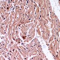 19 - Anti-VEGFA Antibody AP61525