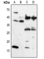 1 - Anti-VEGFA Antibody AP61525