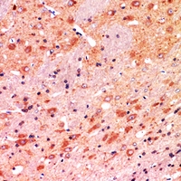 19 - Anti-CALB1 Antibody AP61526
