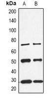 1 - Anti-CALB1 Antibody AP61526