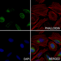 3 - Anti-CCR6 Antibody AP61529