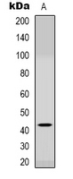 1 - Anti-CCR6 Antibody AP61529