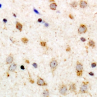 19 - Anti-GPR126 Antibody AP61531