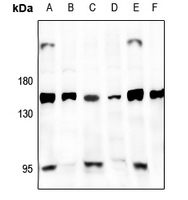 1 - Anti-GPR126 Antibody AP61531