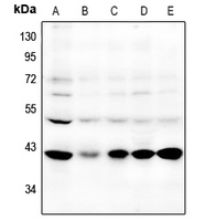 1 - Anti-GPR87 Antibody AP61532