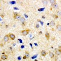 19 - Anti-NPY5R Antibody AP61533