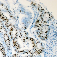 19 - Anti-HNF4 alpha Antibody AP61535