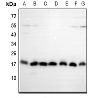 1 - Anti-EIF5A2 Antibody AP61537