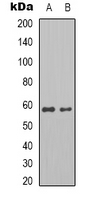 1 - Anti-Pyruvate Kinase Antibody AP61538