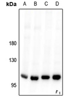 1 - Anti-VPS34 Antibody AP61540