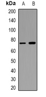 1 - Anti-CD93 Antibody AP61542