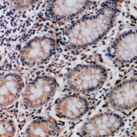 19 - Anti-Collagen 17 alpha 1 Antibody AP61544