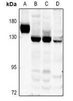 1 - Anti-Collagen 17 alpha 1 Antibody AP61544