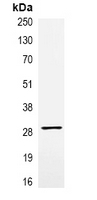 5 - Anti-VSV-G-tag Antibody AP61562