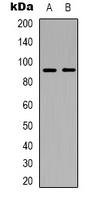 1 - Anti-ABCB5 Antibody AP61564