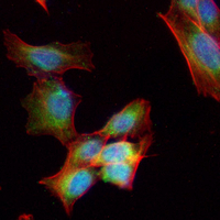 3 - Anti-Alpha-actin-1 Antibody AP61565