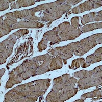 19 - Anti-Alpha-actin-1 Antibody AP61565