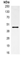 5 - Anti-Alpha-actin-1 Antibody AP61565