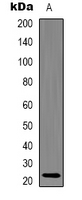 1 - Anti-Alpha-crystallin C Antibody AP61566