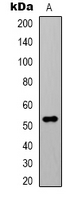 1 - Anti-Alpha-tubulin (Acetyl-K40) Antibody AP61568