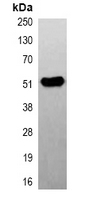 5 - Anti-Beta2A-tubulin Antibody AP61569