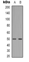 1 - Anti-Beta2A-tubulin Antibody AP61569