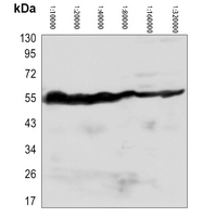 0 - Anti-Beta-tubulin Antibody-HRP labled AP61572
